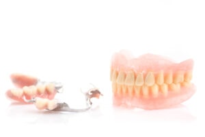 Photo of full and partial dentures.