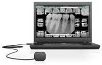Sunnyvale Dentist Digital Xrays