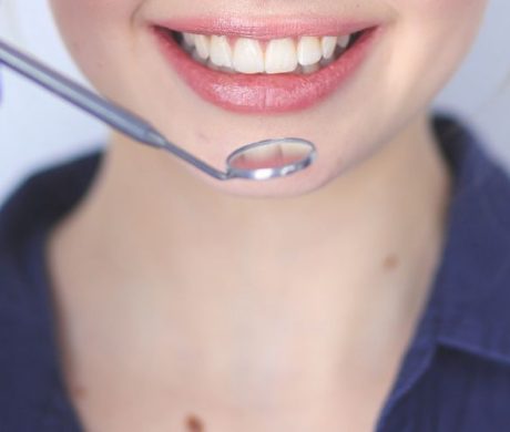 Dental Checkup