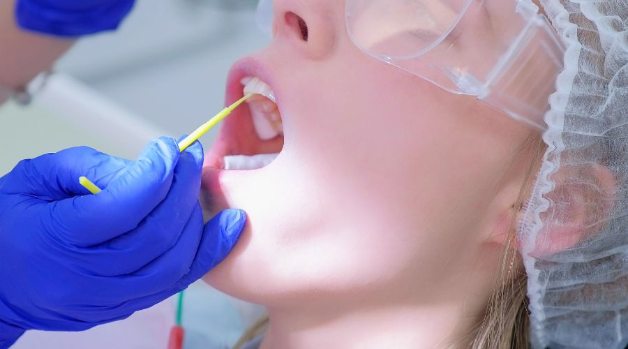 Fluoride Treatment
