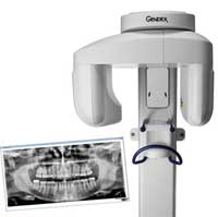 Panoramic Digital Xrays