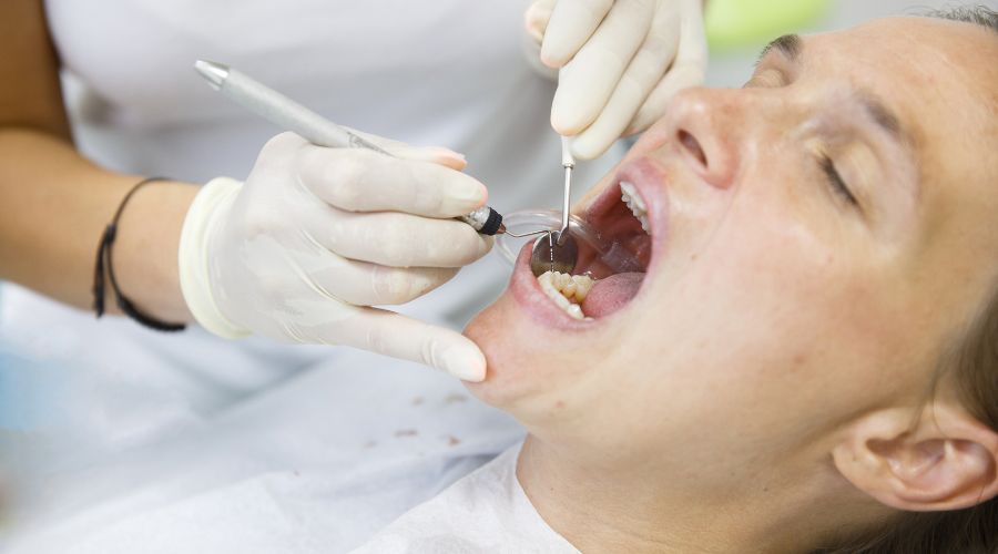 Periodontal Disease
