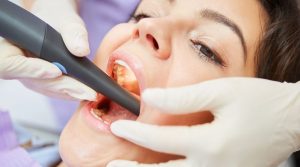 Root Canal Therapy