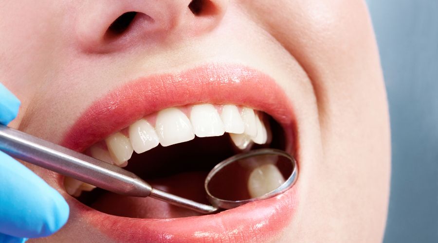 Sealants