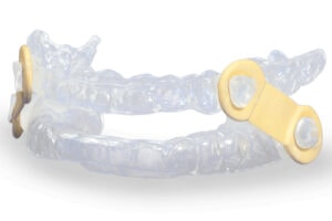 Photo of a snore guard device.