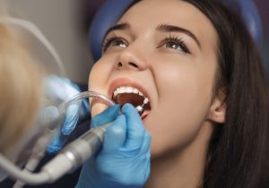 Teeth Cleaning