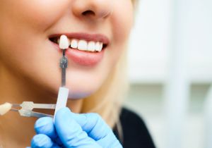 Zoom Teeth Whitening